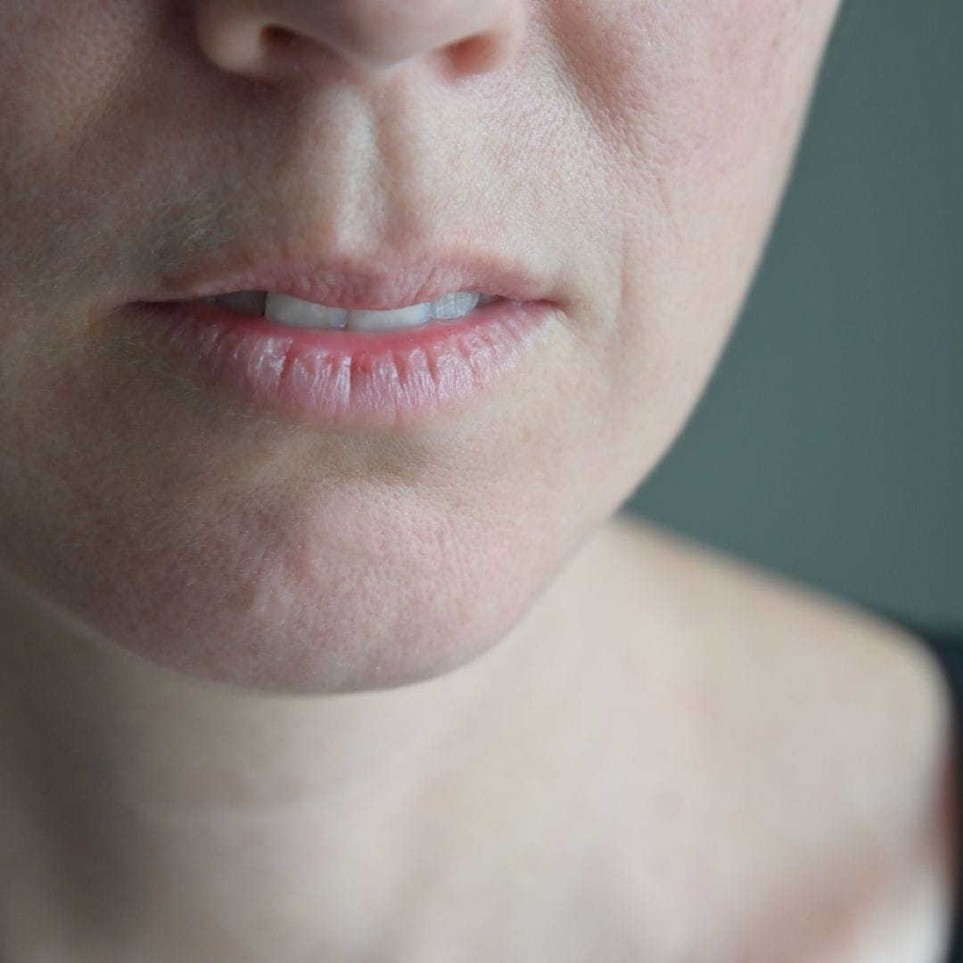Feature Image - Do You Have a Dry Mouth Here’s How to Treat Xerostomia.