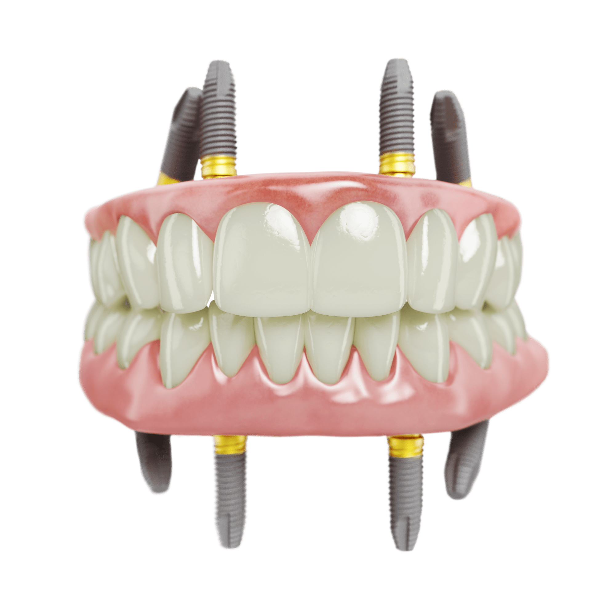 How Long Does All On 4® Last Next Smile