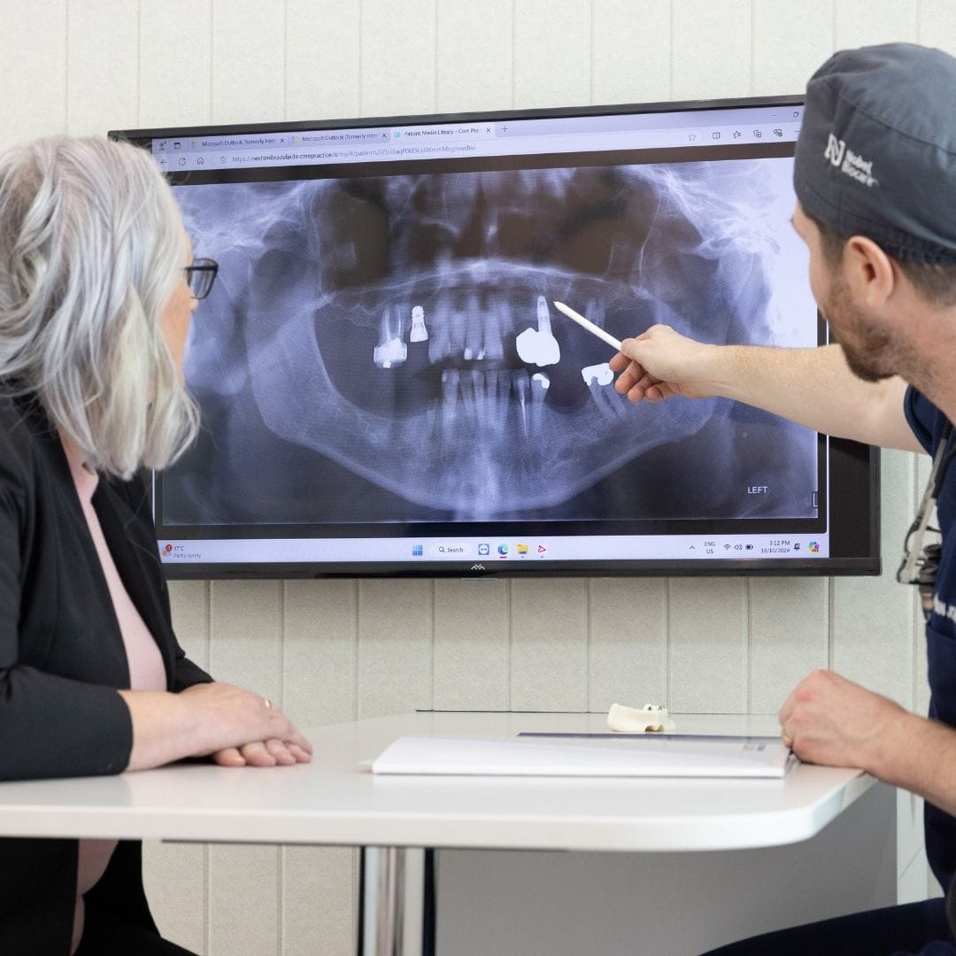 Feature Image - What is Full Dental Reconstruction