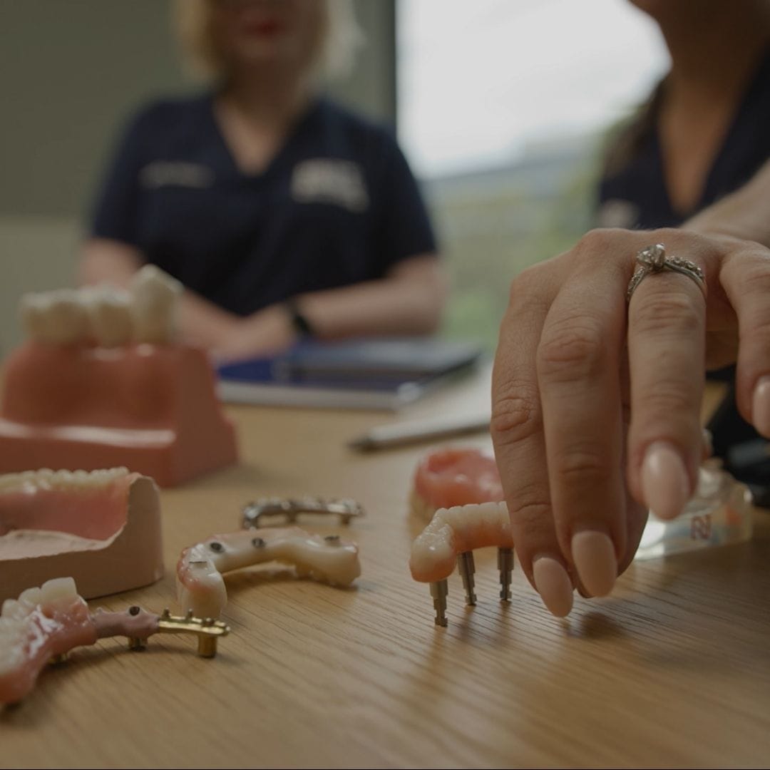 Feature Image - The History of Dental Implants and Innovations of All-on-4®