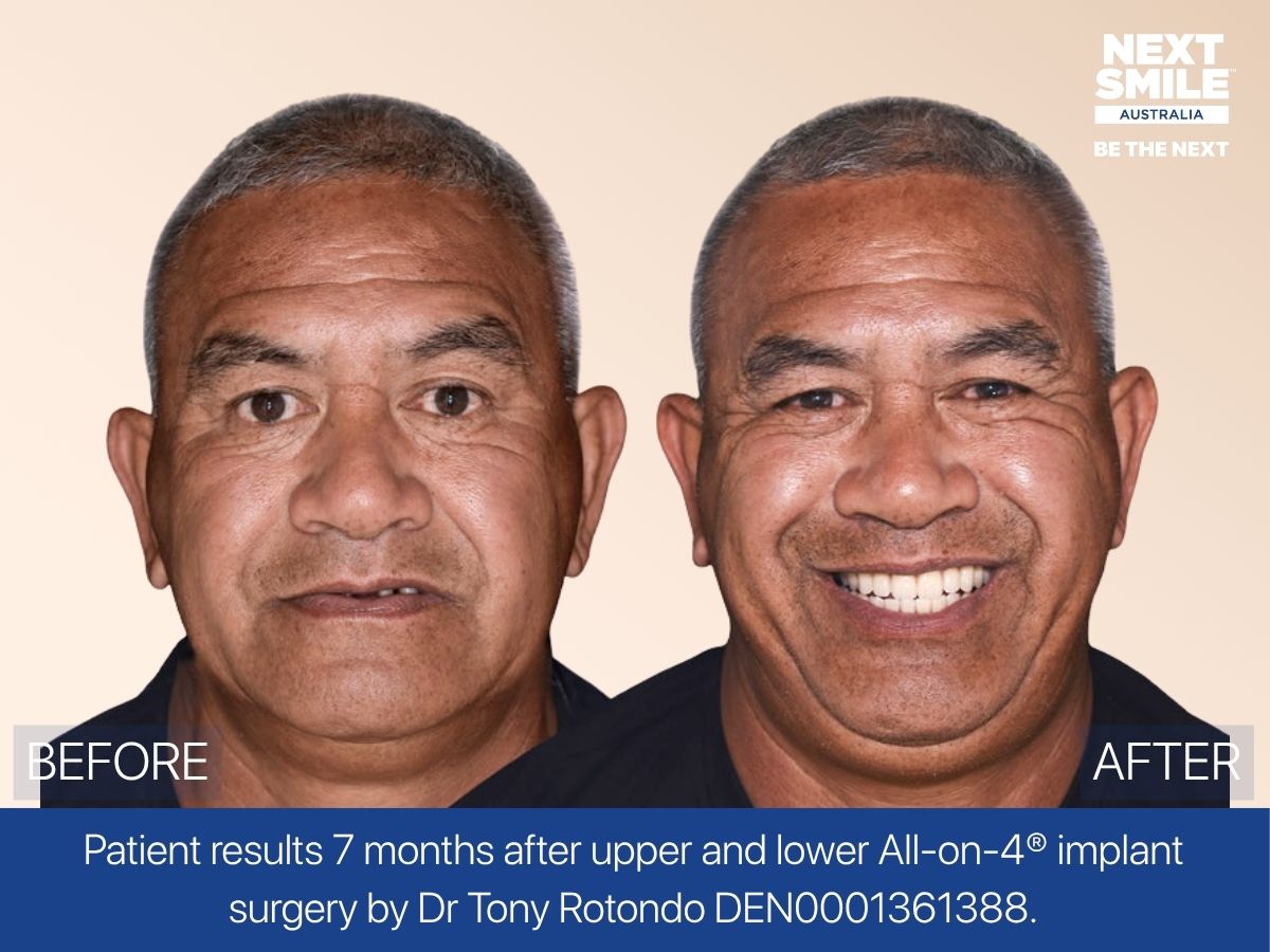 Simon M-Before-and-After