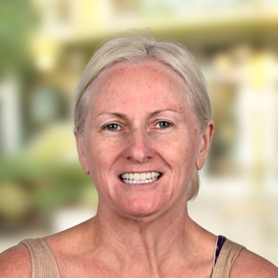 feature image for overdentures or 'clip-in' and 'snap-on' dentures page